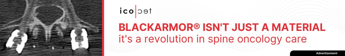 Learn How BlackArmor Implants Improve the Treatment of Patients with Spinal Neoplasms